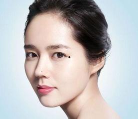 明星点痣,揭秘点痣术如何重塑明星颜值巅峰